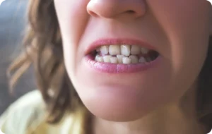 Sourire aux dents alignées