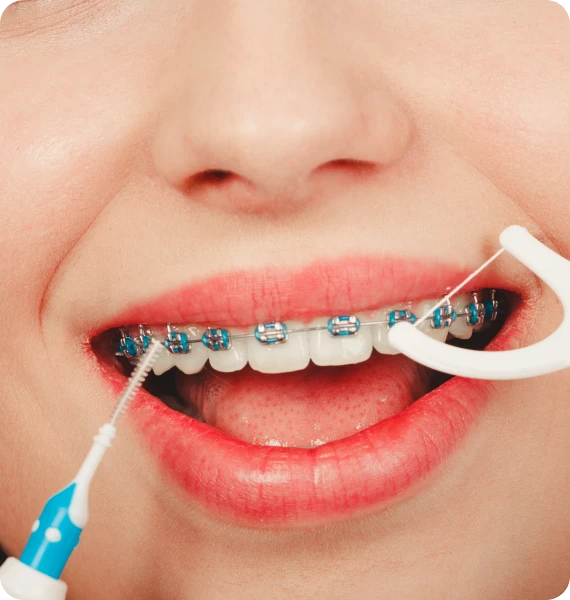 Nettoyage entre les dents avec un appareil multi-attaches