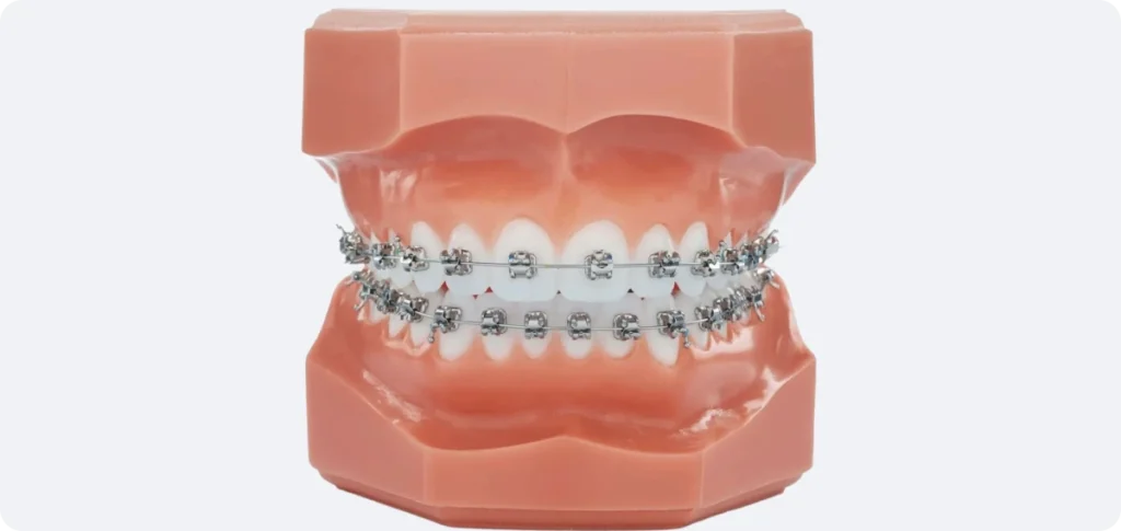 Multi-attaches métalliques