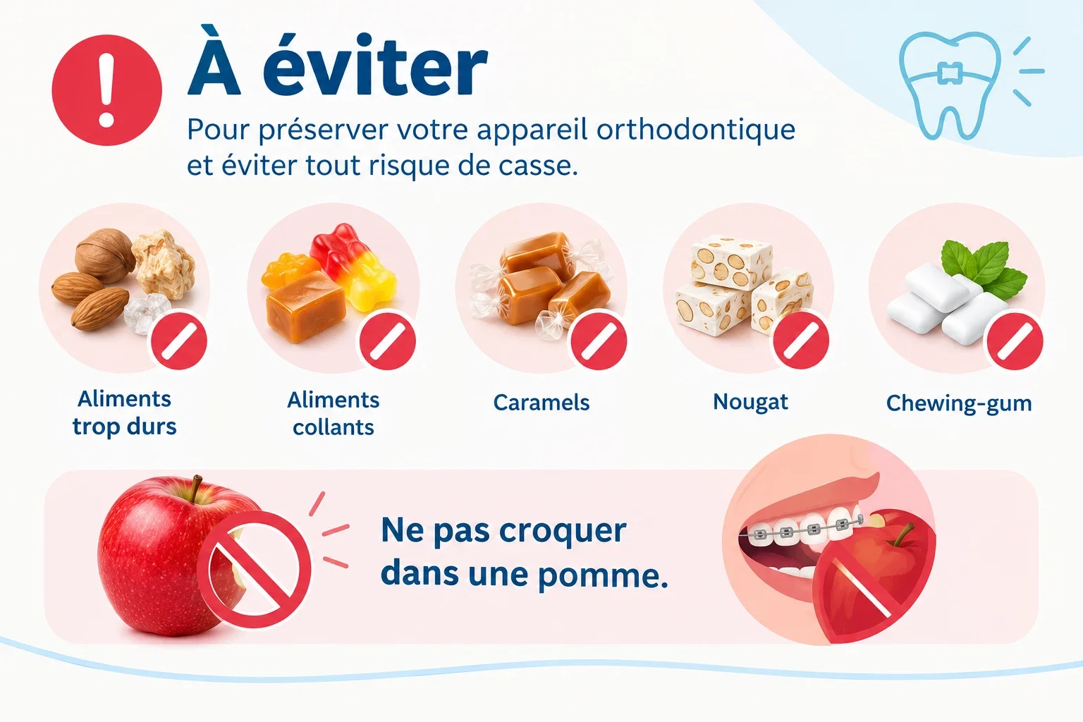 Aliments à éviter avec un appareil orthodontique : aliments trop durs, aliments collants, caramels, nougat, chewing-gum ; ne pas croquer dans une pomme